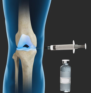 fluid in knee home treatment